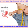 How effective Sleeve Gastrectomy single incision in India for weightloss treatment ?