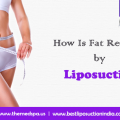 How Is Fat Removed by Liposuction?