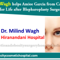 Aimee from California is Grateful to Dr Milind Wagh for her Blepharoplasty Surgery