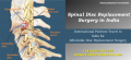 Get relief for you back with Spinal Disc Replacement Surgery in India