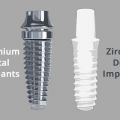 Titanium vs Zirconia Dental Implants