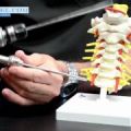 Endoscopic Spine Institute - Dr. Tony Mork
