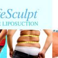 SafeSculpt laser liposuction