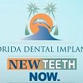 Florida Dental Implants and Oral Surgery
