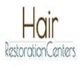 Affordable Hair Transplants Los Angeles