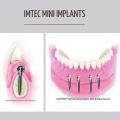 Implant Dentistry Hampton, VA