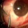Doctor Oleg Gorenburg, Brooklyn Eye Clinic