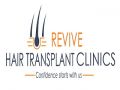 Best hair transplant Los Angeles - Revive hair restoration