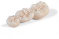 Use Dental Crown to Correct Your Dental Flaws