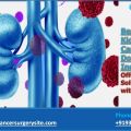 Best Kidney Cancer Doctors Of India Offers Safe Solution with Care