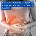 Expanding Horizons of Healing: Advancements in Colon Cancer Surgery