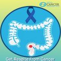 Get Respite from Cancer with Low Cost of Colon Cancer Treatment India