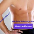Male Breast Reduction Surgery - Aftercare and Recovery