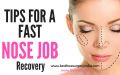 Nose Job – Quick guide to recovery