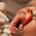 Dental Restorative Treatment | Dental Restoration