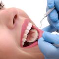 Dental Root Canal treatment | Root Canal Therapy