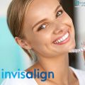 Beautify Your Teeth with Invisalign Dentist in San Diego