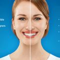 To Get Your Hands on the Best Invisalign Find a Doctor