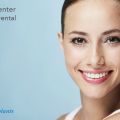 Opt for the Best Dental Implant Cost San Diego