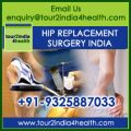 A Step in the Right Direction: Best Hip Replacement Surgery Hospitals in India