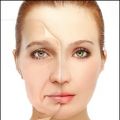 A Major Chunk Of International Patients Opting For Facelift Surgery In India