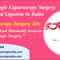 Safe Gynecologic Laparoscopy Surgery For Tubal Ligation In India