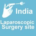 India Laparoscopy Surgery Site Consultants