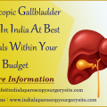 Laparoscopic Gallbladder Surgery In India At Best Hospitals Within Your Budget