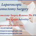 Laparoscopic Myomectomy Surgery For Fibroids And Infertility Treatment