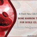 Improving Sickle Cell Disease through Stem Cell Transplantation in India
