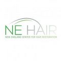 New England Center For Hair Restoration