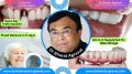 Best Dentist for Full Mouth Dental Implants Clinic in Ahmedabad: Dr. Bharat Agravat