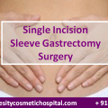 Single Incision Sleeve Gastrectomy Surgery a Key to Obesity Lock