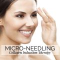 Microneedling Treatment Therapy