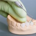 The 4 Common Issues Your Dental Bridge May Be Causing
