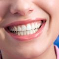 6 Natural Ways to Keep Your Gums Healthy