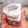 6 Reasons Why You Should Choose a Dental Bridge
