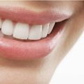 6 Signs You’re a Good Candidate for Dental Veneers