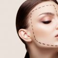 7 Irrational Myths About Circular Facelift
