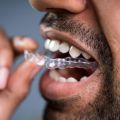 What Your Life Will Be Like After Invisalign Treatment