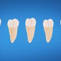 5 Tooth Fractures Facts You Must Be Aware Of