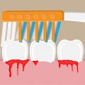 8 Myths About Gingivitis That Should Be Addressed ASAP