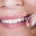 8 Commonly Asked Questions About Bone Grafting