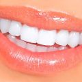 How to Properly Maintain Dental Veneers
