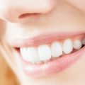 Why Tooth Whitening before the holidays is a good idea in Brickel, Fl?
