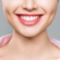 Full Mouth Reconstruction vs. Smile Makeover