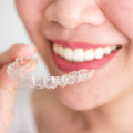 Invisalign Reveals Your Most Beautiful Smile