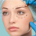 How Do You Get Rid of Eye Bags Under Your Eyes with Blepharoplasty in Miami, FL?