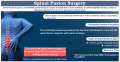 Most Cost-Effective Spinal Fusion Surgery in India