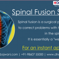 Say Goodbye to Back Pain With Spinal Fusion Surgery in India